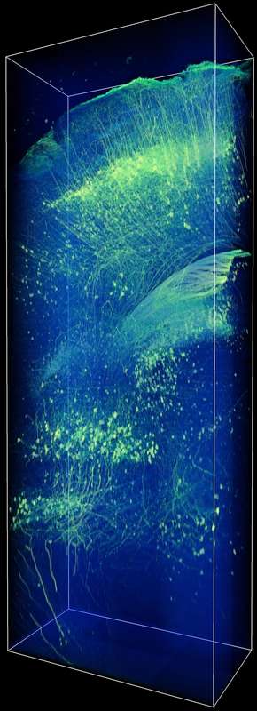 CLARITY-processed Thy1-eYFP-expressing mouse brain. Image courtesy of Dr. Raju Tomer, Deisseroth Lab, Stanford University. Image acquired with FV1200 confocal system using 515nm laser and CLARITY-matched 25x lens. Source: Olympus